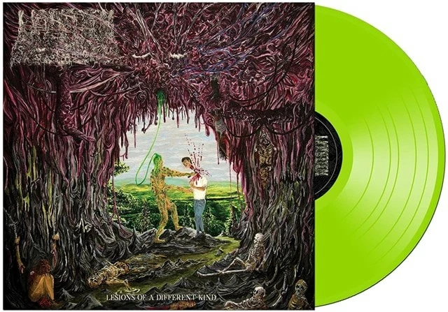 Lesions of a Different Kind (Vinyl 12" Album) - Undeath 3 Lesions of a Different Kind (Vinyl 12" Album) - Undeath